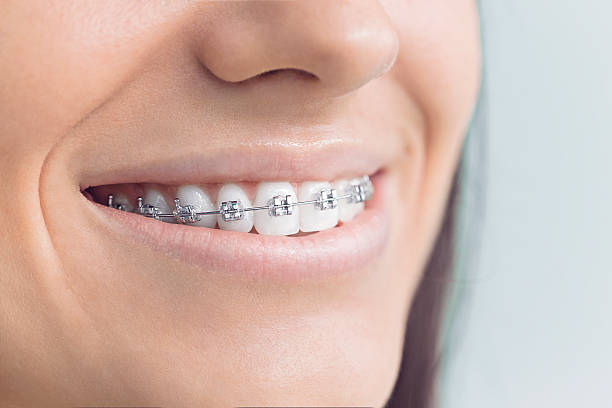 Emergency Dental Services in Teague, TX